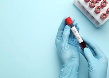 STI cases rise, highest rates among young adults