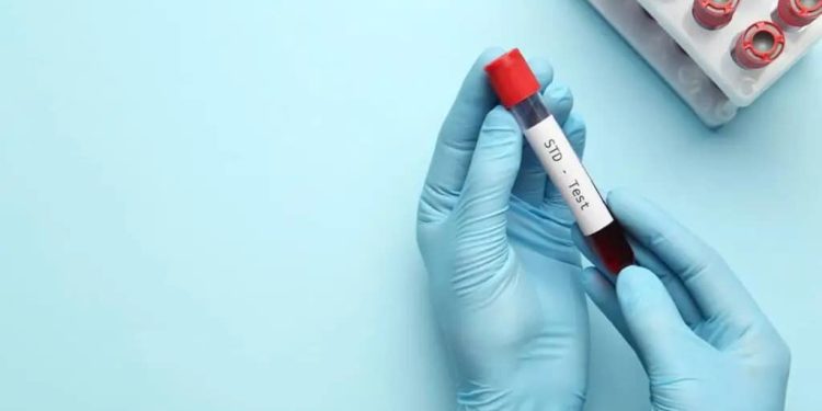 STI cases rise, highest rates among young adults